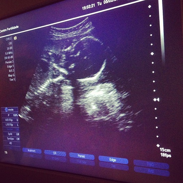 Perlla posta foto de ultrassom do bebê (Foto: Instagram / Reprodução)