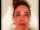 Luciana Gimenez exibe rosto vermelho após tratamento estético