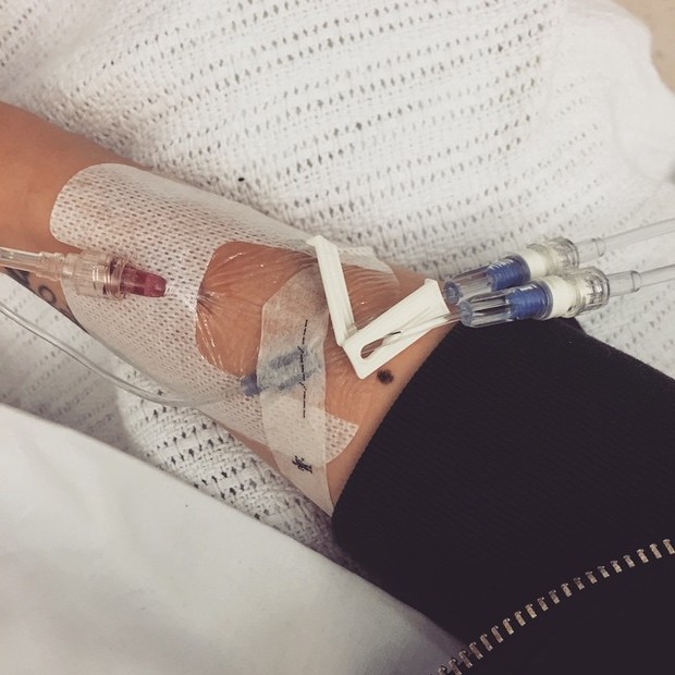 Jessie J posta foto de seu braço (Foto: Reprodução/Instagram)