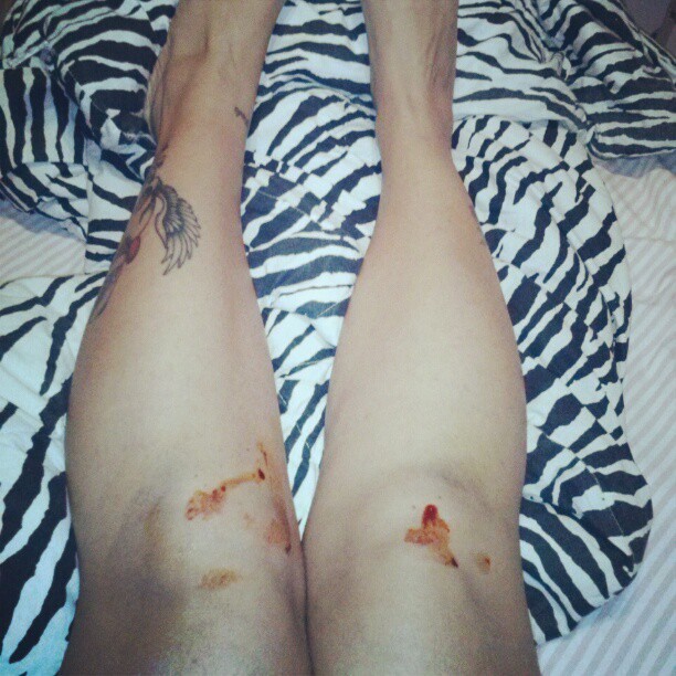 Sabrina Boing Boing mostra joelhos sangrando após pagar promessa (Foto: Instagram)