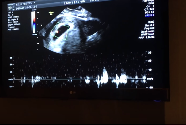Kelly Key faz primeira ultrassonografia (Foto: Reprodução/Youtube)