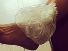Antônia Fontenelle mostra tornozelo com bolsa de gelo: 'Foi uma torção'