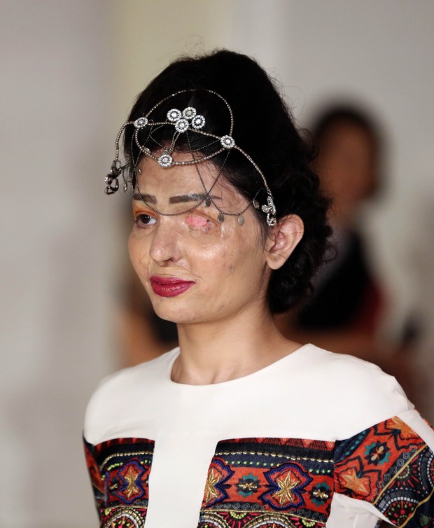 Reshma Bano,  indiana que sofreu ataque com ácido, desfila na semana de moda de Nova York (Foto: AFP)