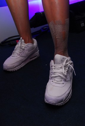 Detalhe da perna machucada de Thaila Ayala (Foto: Marcelo Machado/Ag Haack)