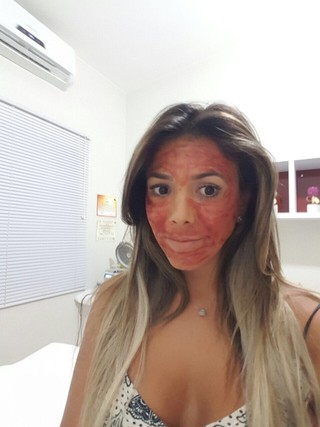 Ex-BBB Fabiana Teixeira aplica sangue no rosto (Foto: Arquivo Pessoal/Divulgação)