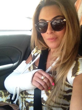 Ex-BBB Monique de braço quebrado (Foto: Reprodução/Instagram)