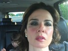 Luciana Gimenez aparece com o rosto vermelho: 'Queimei a cara'